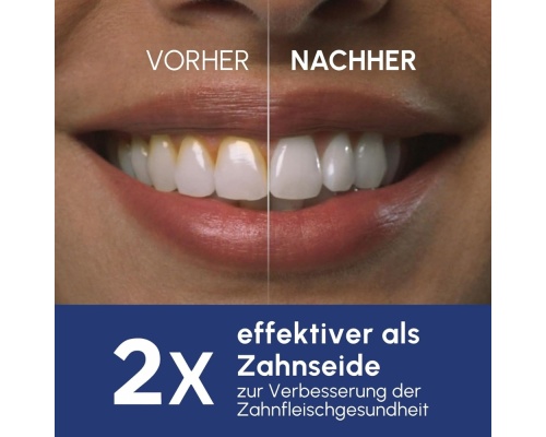 Waterpik Water Flosser 50983020 Λευκό Waterpik Water Flosser 50983020 Λευκό