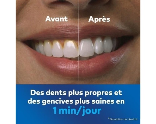 Waterpik Water Flosser 50983020 Λευκό Waterpik Water Flosser 50983020 Λευκό