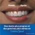 Waterpik Water Flosser 50983020 Λευκό Waterpik Water Flosser 50983020 Λευκό